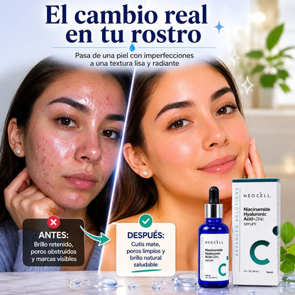 NeoCell Serum | Menos imperfecciones, más confianza en tu piel